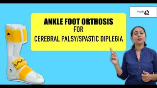 Things you should know about ANKLE FOOT ORTHOSIS [upl. by Gabie]