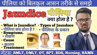 Jaundice  पीलिया   Types of Jaundice  Symptoms of Jaundice  What is main cause of jaundice [upl. by Abernon298]