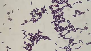 Gram staining of Enterococcus [upl. by Oiram]