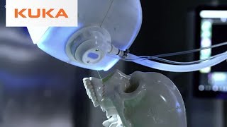 KUKA Medical Robotics  The Future of Medicine [upl. by Richelle]