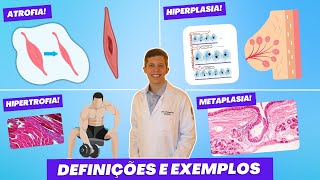 Adaptações Celulares Atrofia Hipertrofia Hiperplasia e Metaplasia  Definições e Exemplos [upl. by Manara]