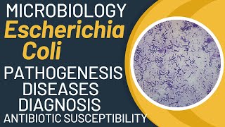 Escherichia coli pathogenesis  E coli microbiology  e coli general properties [upl. by Yrreb]