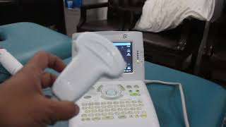 Portable Ultrasound Sonosite 180 review [upl. by Licec]