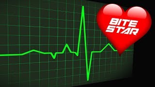 ❤️ HEARTBEAT Sound Effect 🩺 Slow to Fast Flatline and Heart Attack Sounds Bite Star [upl. by Amsirahc793]