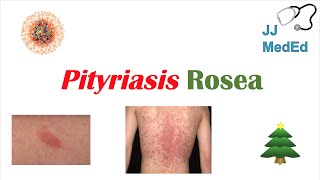 Introduction to Pityriasis Rosea  Possible Causes Symptoms and Treatment [upl. by Gonagle]