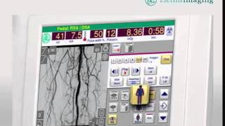 Ziehm Imaging SmartVascular [upl. by Ackler]