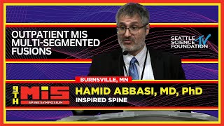 Outpatient MIS MultiSegmented Fusions  Hamid Abbasi MD [upl. by Wolfe837]