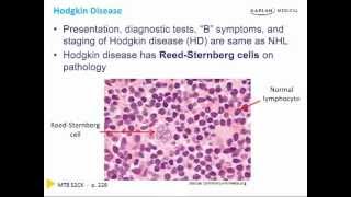 Conrad Fischers USMLE Step 2 CK High Yield Prep  Lymphoma [upl. by Niar246]