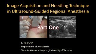 Image Acquisition and Needling in UltrasoundGuided Interventional Procedures  Part 1 [upl. by Atiuqrahs267]