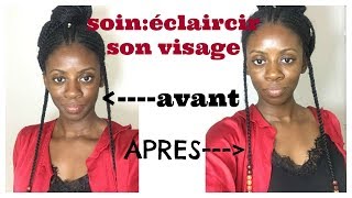 COMMENT ECLAIRCIR SON VISAGE soin visage coup déclat [upl. by Koslo]