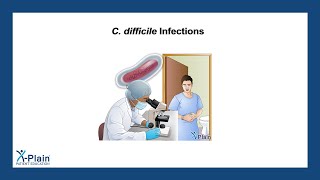 C difficile Infections [upl. by Allan862]