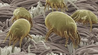 Good Question What Are Dust Mites [upl. by Nettie397]