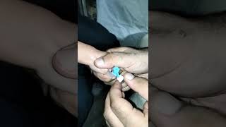 I v cannula procedure easy pass 22sizeyoutuberyoutubeshortsyoutubembbsytshortyoutubeshort [upl. by Crosley]