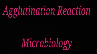 Agglutination reaction in hindi [upl. by Anicnarf414]