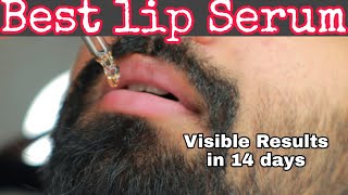 Effective Lip Serum for Dark Lips  No Chemicals  உங்க லிப்ஸ் டார்க்கா இருந்தா இது try பண்ணுங்க [upl. by Iahk884]