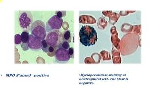 cytochemical staining [upl. by Florencia]