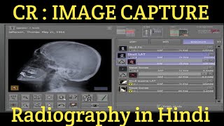 Image Capture  Computed Radiography [upl. by Nnoved286]