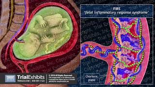 Premature Rupture of Membranes  CRASH Medical Review Series [upl. by Carri]