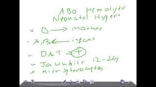 QUICK PEDIATRICS Criteria to diagnose ABO incompatibility [upl. by Filia]