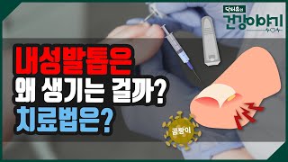 내성발톱은 왜 생기는걸까 치료법은 닥터유의 건강이야기 [upl. by Ettevi]