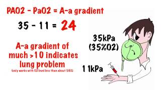 Arterial blood gas interpretation in 5 min [upl. by Franciskus635]