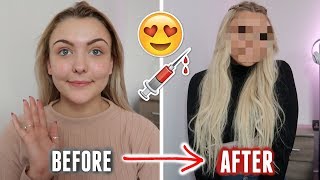 The ULTIMATE Glow Up Transformation Video i got LOTS of filler [upl. by Llewen]