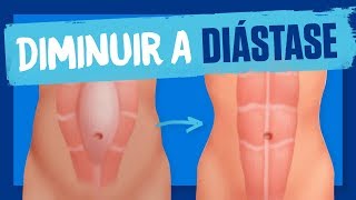 EXERCÍCIO para a DIÁSTASE abdominal Como diminuir a diástase [upl. by Anaeirb]