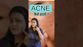 Homeopathic medicine for acne youtubeshorts acne acnetreatment [upl. by Willey]