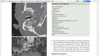 CORE REQUISITES of neuroradiology [upl. by Aihsekal348]