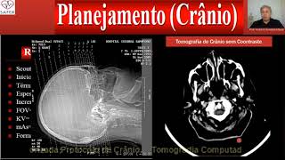 Tomografia Protocolo de Cranio Mix video 2018 [upl. by Sylas747]