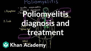 Poliomyelitis diagnosis and treatment  Infectious diseases  NCLEXRN  Khan Academy [upl. by Cuthburt404]