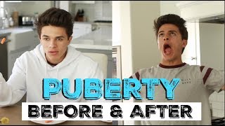 PUBERTY BEFORE amp AFTER  Brent Rivera [upl. by Yuk]