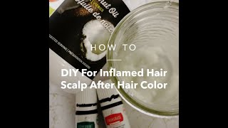 DIY for Inflamed Itchy Scalp after Hair Color with Young Living Essential Oils [upl. by Zurc]