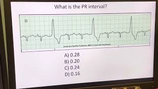 Telemetry Analysis Video 3 Measuring the Duration of the PR Interval [upl. by Vins]