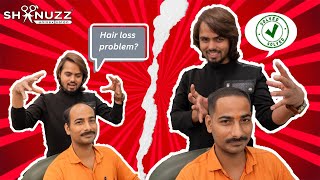 Less Hair Issue Solved ✅  Shanuzz Salon ThickFiber [upl. by Odelle488]