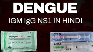 Dengue Test Kaise Kiya Jata Hai  डेंगू परीक्षण  Dengue Positive  Dengue test report  dengue [upl. by Robbert235]