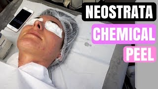 NEOSTRATA CHEMICAL SKIN PEEL  SKIN CARE  BEAUTY [upl. by Annaitsirhc]