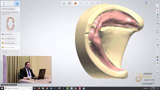 Digital Dentures A Crash Course on How to Design using 3Shape  Logan Woomer [upl. by Markus]