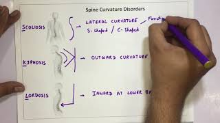 Spine Curvature Disorders  Scoliosis Kyphosis Lordosis [upl. by Auohs337]