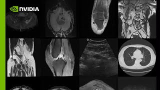 Create Infinite Medical Imaging Data with Generative AI [upl. by Nylodnarb]