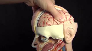 Increased ICP Intracranial Pressure Nursing Care Animation [upl. by Ferne]