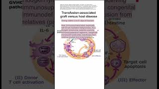 Transfusionassociated graft versus host disease [upl. by Ecerahc]