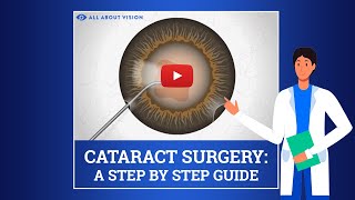 What to Expect During amp After Cataract Surgery [upl. by Dougherty]