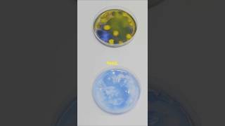 We Found Bacteria That Eats Plastic [upl. by Chessy]