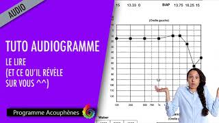 Acouphènes  Tuto audiogramme  le lire et ce quil révèle sur vous [upl. by Hatch111]