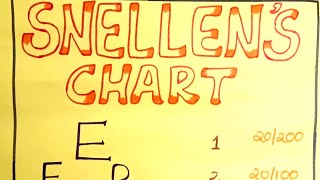 Snellens chart for eye examination [upl. by Ymas]