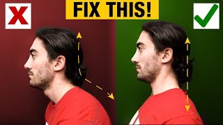 How to Fix Forward Head  Slumped Posture PERMANENTLY [upl. by Latvina]