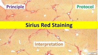 Sirius Red Staining Made Easy Beginners Overview  Principle Protocol amp Interpretation Tips [upl. by Siesser634]