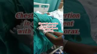 Chest tube insertion in covid patient with pneumothorax  By Dr Raj Mishra [upl. by Assylem633]