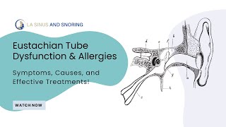 Eustachian Tube Dysfunction amp Allergies Symptoms Causes and Effective Treatments [upl. by Bjork112]